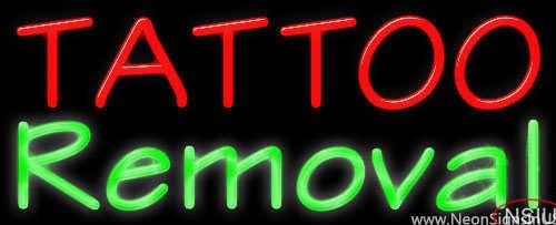 Tattoo Removal Real Neon Glass Tube Neon Sign